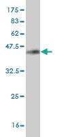 Anti-HNRNPM Mouse Monoclonal Antibody [clone: 3F7]