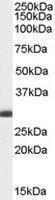 Anti-BCAP31 Goat polyclonal antibody unconjugated