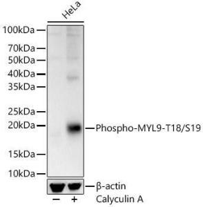 Western blot analysis of HeLa, using Anti-MYL9 (phospho Thr18 + Ser19) Antibody (A305466) at 1:3,000 dilution