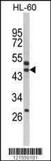 Anti-SERPINB7 Rabbit Polyclonal Antibody (AP (Alkaline Phosphatase))