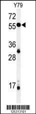 Anti-NOB1 Rabbit Polyclonal Antibody