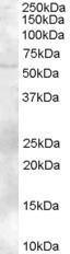 Antibody anti-ZBTB32 100 µg