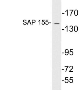 Western blot analysis of lysates from Jurkat cells using Anti-SAP 155 Antibody