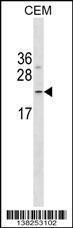 Anti-FNDC4 Rabbit Polyclonal Antibody (AP (Alkaline Phosphatase))