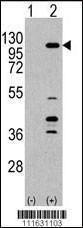 Anti-PI3CKG Rabbit Polyclonal Antibody (FITC (Fluorescein))