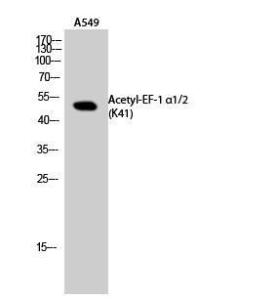 Western blot analysis of A549 cells using Anti-EEF1A-pan (acetyl Lys41) Antibody