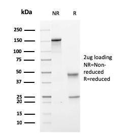 SDS-PAGE analysis of Anti-PMEPA1 Antibody [PMEPA1/2697] under non-reduced and reduced conditions; showing intact IgG and intact heavy and light chains, respectively. SDS-PAGE analysis confirms the integrity and purity of the antibody.