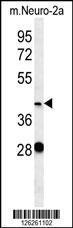 Anti-VASH2 Rabbit Polyclonal Antibody (AP (Alkaline Phosphatase))