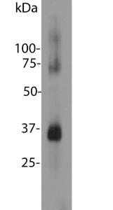 Blot of bovine retinal extracts probed with Anti-Rhodopsin Antibody. The Antibody stains a band corresponding to retinal rhodopsin at about 35 kDa