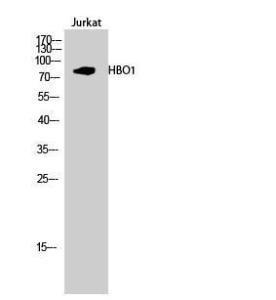 Antibody anti-MYST2 100 µg