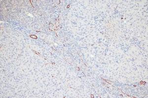 Immunohistochemistry analysis of paraffin-embedded rat ovary using Anti-MYL9 (phospho Thr18 + Ser19) Antibody (A305466) at a dilution of 1:100 (20x lens). Perform microwave antigen retrieval with 10 mM Tris/EDTA buffer pH 9.0 before commencing with IHC staining protocol