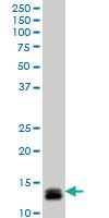 Anti-ID1 Mouse Monoclonal Antibody [clone: 4G11]