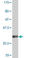 Anti-ODF2 Mouse Monoclonal Antibody [clone: 1A1]