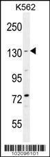 Anti-BAI1 Rabbit Polyclonal Antibody (Biotin)