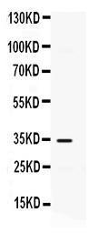 Anti-CXCL10 Rabbit Polyclonal Antibody