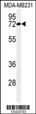 Anti-CJ119 Rabbit Polyclonal Antibody