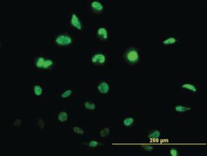 Anti-ID1 Mouse Monoclonal Antibody [clone: 4G11]