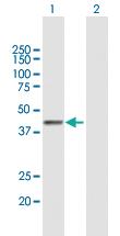 Anti-PLB1 Mouse Polyclonal Antibody