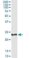 Anti-RCVRN Antibody Pair