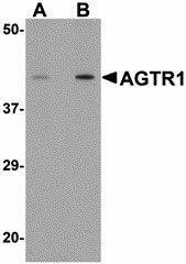 Anti-AGTR1 Rabbit Polyclonal Antibody