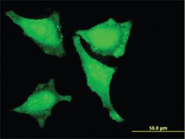 Anti-LMO3 Mouse Monoclonal Antibody [clone: 4A8]