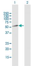 Anti-PLB1 Mouse Polyclonal Antibody