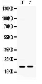 Anti-CXCL11 Rabbit Polyclonal Antibody