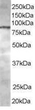 Anti-ACAP1 Antibody (A83972) staining (0.5 µg/ml) of Jurkat lysate (RIPA buffer, 35 µg total protein per lane). Primary incubated for 1 hour. Detected by western blot using chemiluminescence