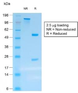 SDS-PAGE analysis of Anti-Chromogranin A Antibody [rCHGA/413] under non-reduced and reduced conditions; showing intact IgG and intact heavy and light chains, respectively. SDS-PAGE analysis confirms the integrity and purity of the Antibody