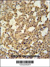 Anti-CJ119 Rabbit Polyclonal Antibody