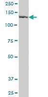 Anti-PLB1 Mouse Polyclonal Antibody