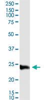 Anti-C1QC Polyclonal Antibody Pair