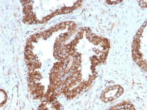 Anti-PMEPA1 Mouse Monoclonal Antibody [clone: PMEPA1/2698]