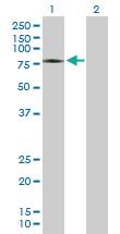 Anti-ZSWIM2 Mouse Polyclonal Antibody