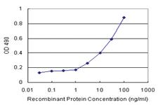 Anti-GALT Antibody Pair