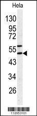 Anti-SERPINH1 Rabbit Polyclonal Antibody (AP (Alkaline Phosphatase))