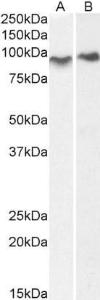 Anti-ACAP2 Antibody (A83973) (0.3µg/ml) staining of Mouse (A) and Rat (B) Lung lysate (35µg protein in RIPA buffer). Primary incubation was 1 hour. Detected by chemiluminescence.