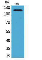 Western blot analysis of 293 cells using Anti-ATP2A2 Antibody