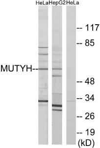 Western blot analysis of lysates from HeLa and HepG2 cells using Anti-MUTYH Antibody. The right hand lane represents a negative control, where the antibody is blocked by the immunising peptide.