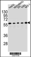 Anti-PAX1 Rabbit Polyclonal Antibody