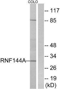 Western blot analysis of lysates from COLO cells using Anti-RNF144A Antibody. The right hand lane represents a negative control, where the antibody is blocked by the immunising peptide