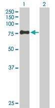 Anti-ZSWIM2 Mouse Polyclonal Antibody