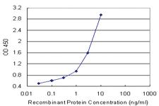 Anti-NOP16 Polyclonal Antibody Pair