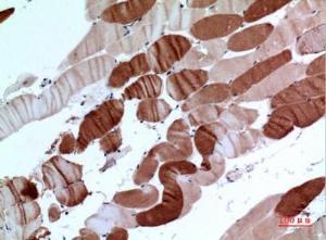 Immunohistochemical analysis of paraffin-embedded human muscle using Anti-ATP2A2 Antibody