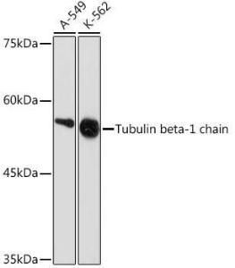 Western blot analysis of extracts of various cell lines, using Anti-beta I Tubulin Antibody [ARC2484] (A305467) at 1:1,000 dilution. The secondary antibody was Goat Anti-Rabbit IgG H&L Antibody (HRP) at 1:10,000 dilution.