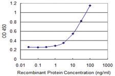 Anti-ZSWIM2 Mouse Monoclonal Antibody [clone: 2G4]