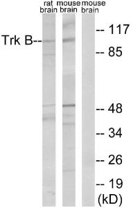 Anti-TrkB Rabbit Polyclonal Antibody