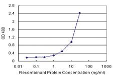 Anti-GALT Polyclonal Antibody Pair