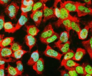 Anti-TAF15 antibody