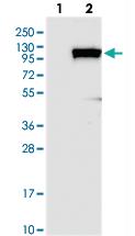 Anti-KIF18A Rabbit Polyclonal Antibody